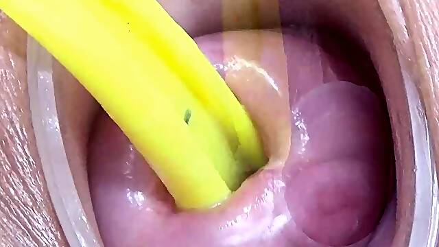 Insertion Videos